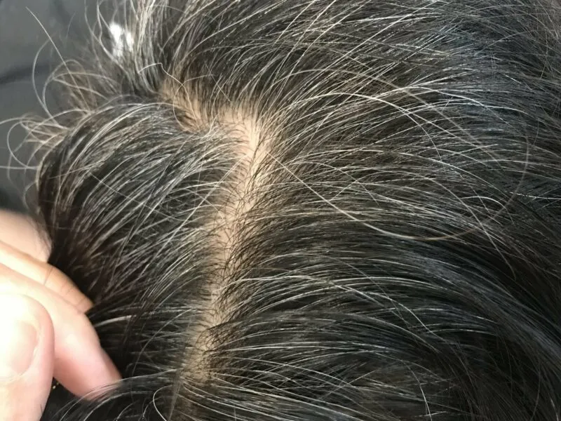 (Greying of hair, photo by Bee Choo Origin, Aug 2017)