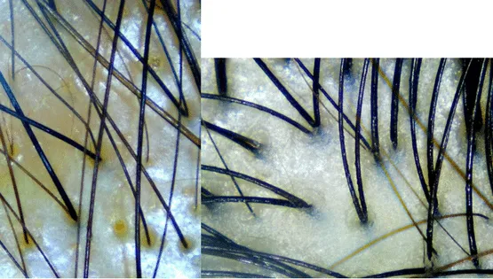 unhealthy vs healthy hair scan