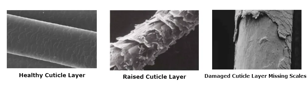 10 MOST POSSIBLE CAUSES OF HAIR LOSS IN YOUNG WOMEN — photo 3