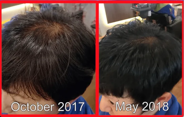 Alanna Tok's hair, before and after Bee Choo herbal treatment