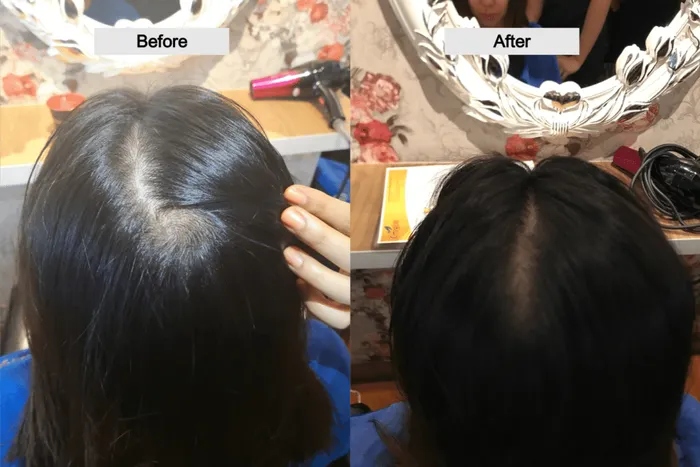 Before and After photo of Rachel