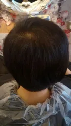 Trixie's scalp progress photo, 23 December 2017
